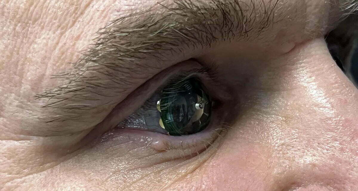 Augmented Reality in a Contact Lens