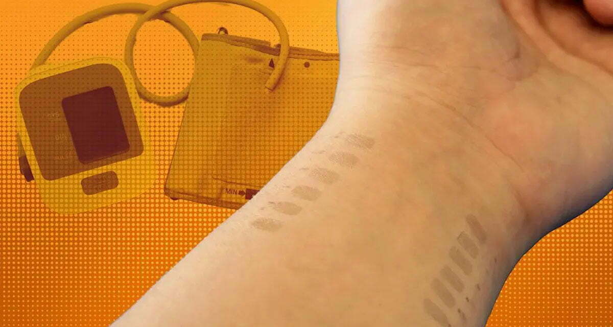 Monitor Blood Pressure with a Graphene Tattoo