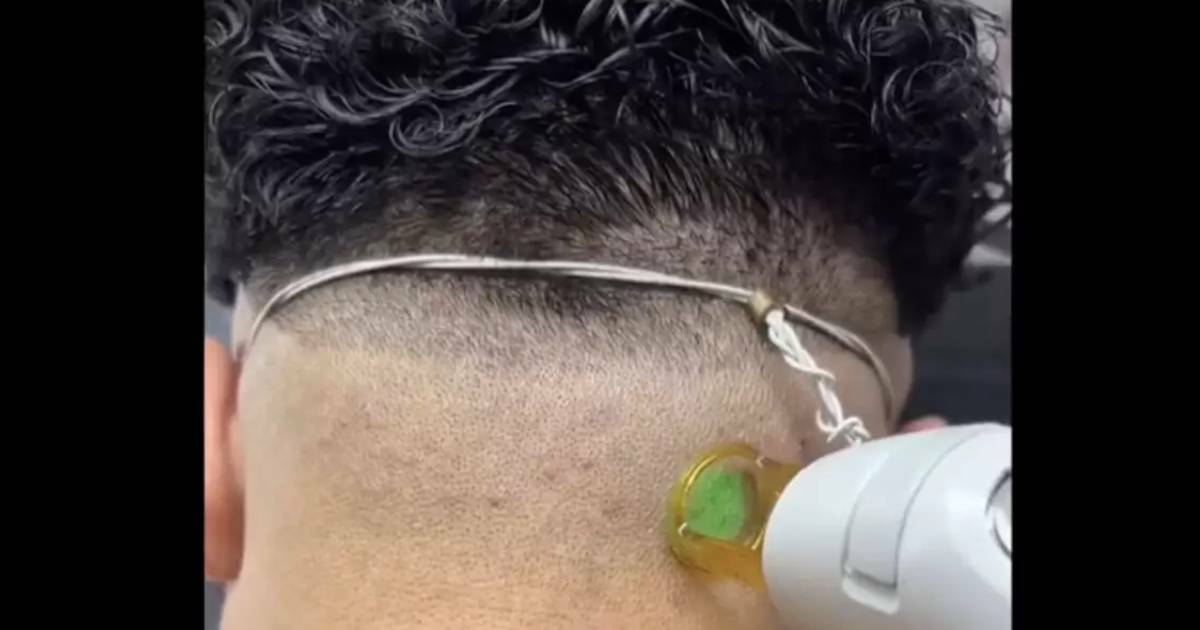 Doctor warns about dangers of men getting ‘permanent haircut’