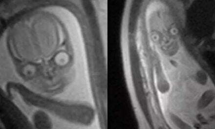 People are horrified after seeing MRI images of a baby inside the womb