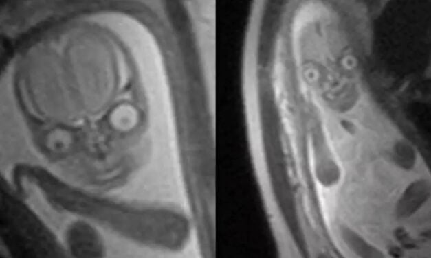People are horrified after seeing MRI images of a baby inside the womb