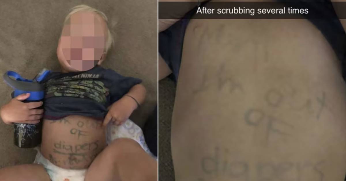 Florida mother says day care wrote on child’s tummy to remind her to bring diapers