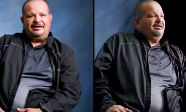 Man with two working penises says women didn’t believe him until they saw them