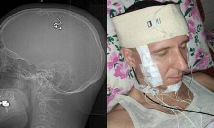 Scientist Claims to Have Performed Brain Surgery on Himself in His Living Room