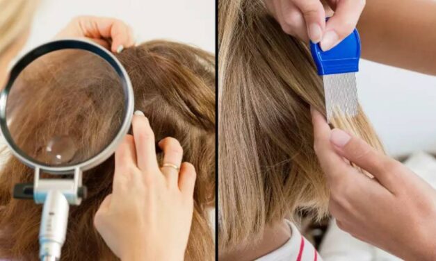 Mum refuses to kill her child’s head lice because she’s vegan and doesn’t want to murder a living thing