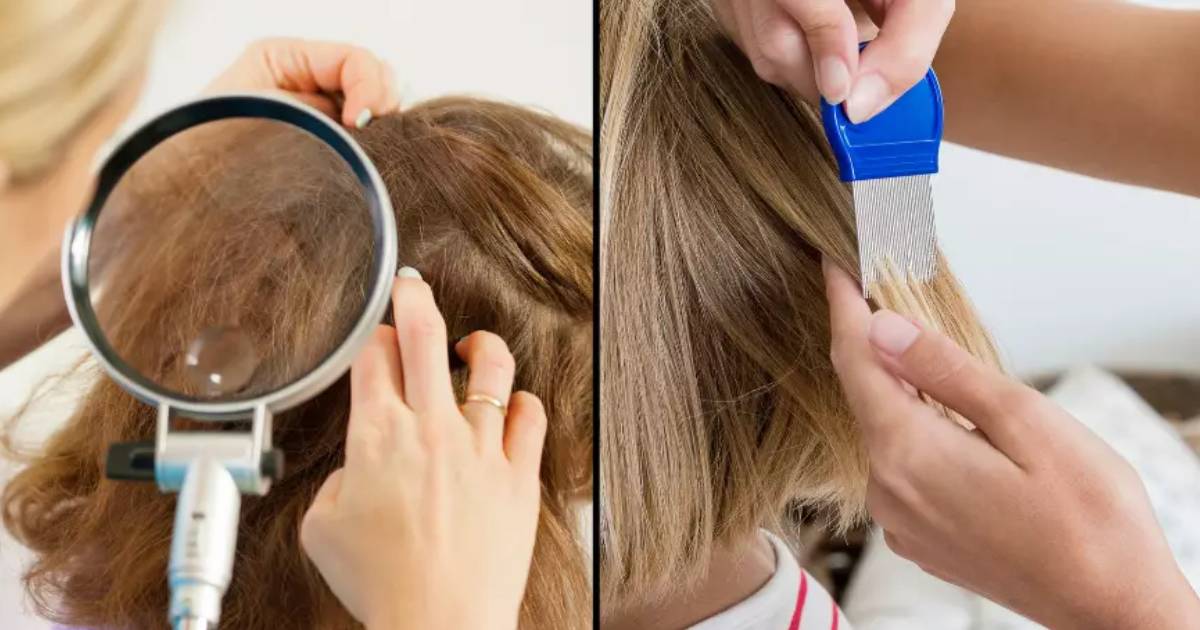Mum refuses to kill her child’s head lice because she’s vegan and doesn’t want to murder a living thing