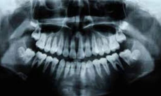 Humans Have a Third Set of Teeth. New Medicine May Help Them Grow