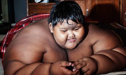 World’s Fattest Child Weighs 192 Kg. at Just 10 Years of Age