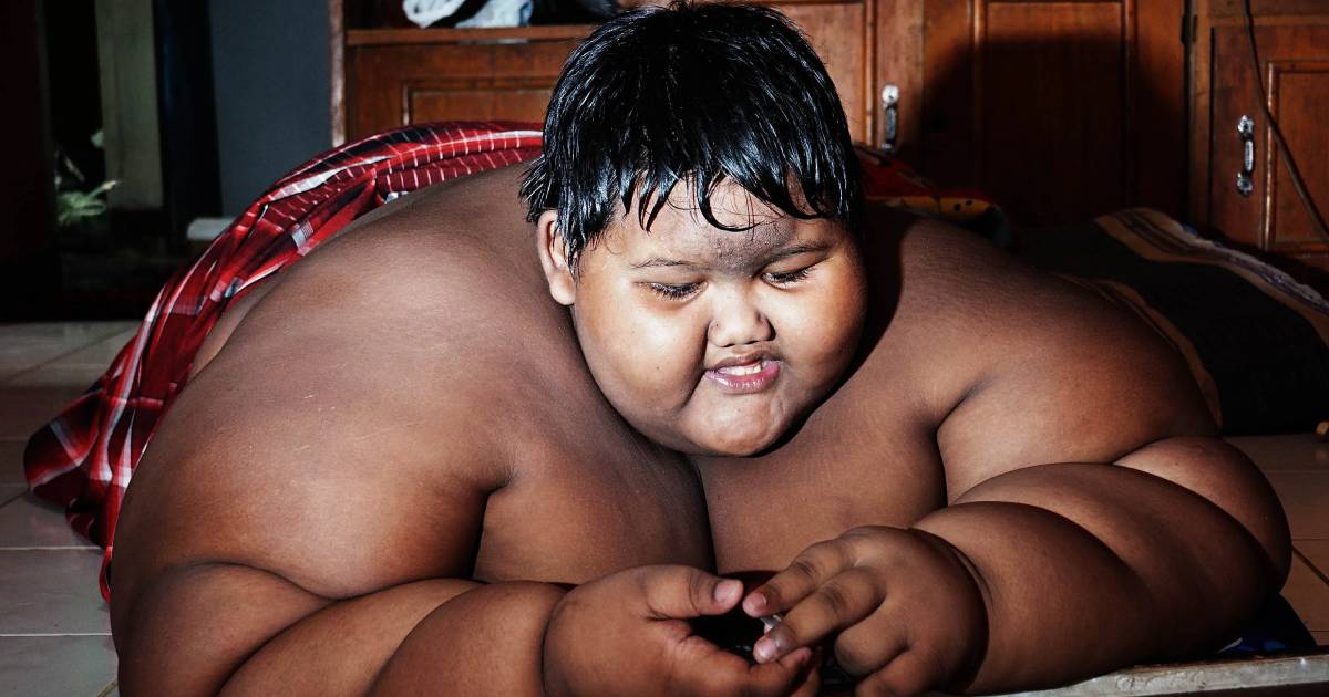 World’s Fattest Child Weighs 192 Kg. at Just 10 Years of Age