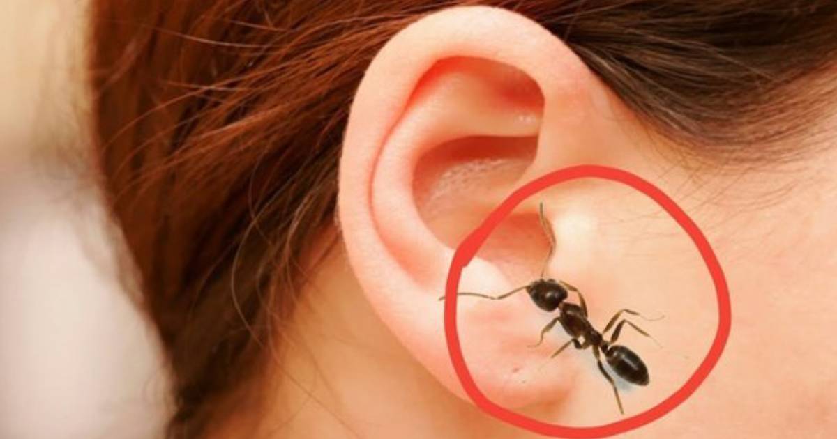 Indian Girl Has Ants Crawling Out of Her Ears Every Day