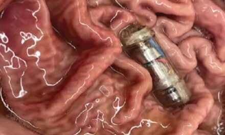 Scientists Create Smart Pill That Vibrates to Make You Feel Full