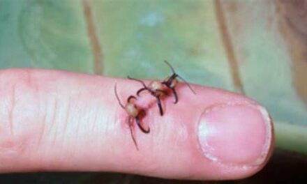 In Some Parts of the World Ant Heads Were Once Used as Stitches