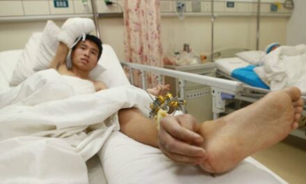 Doctors Save Man’s Severed Hand by Attaching it to His Leg