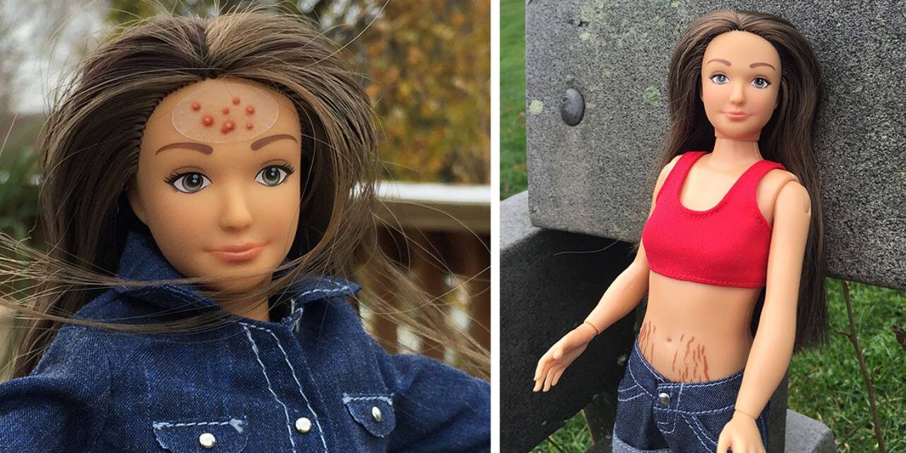 New Realistic Barbie Doll Features Normal Proportions, Acne, Cellulite and Stretch Marks