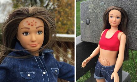 New Realistic Barbie Doll Features Normal Proportions, Acne, Cellulite and Stretch Marks