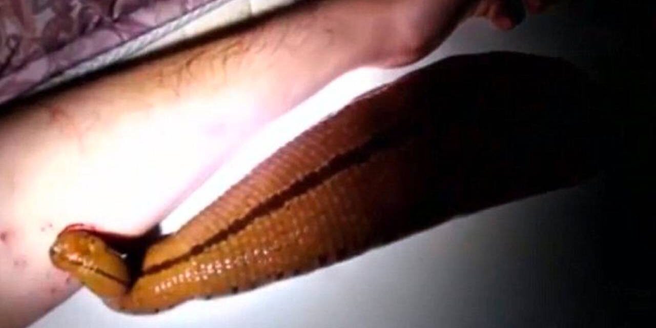 Man Keeps Giant Leech for a Pet, Lets It Feed on His Arm