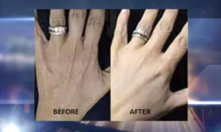 Forget Facelifts, Engagement Ring Selfies Spark New Hand-Lift Craze