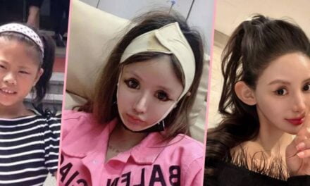 Star-struck China teenage girl splurges US$563,000 of parents’ cash on so much plastic surgery doctors fear one more op could kill her