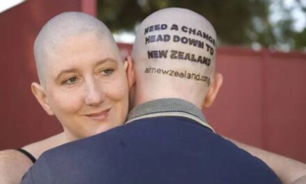 Bald Billboard – Man Uses His Head for Advertising Space for $320 a Day