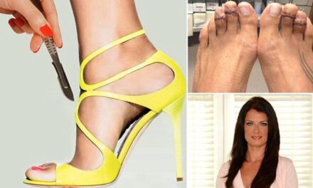 Off with Her Toes! Growing Number Of Women Shortening or Removing Toes to Wear High Heels