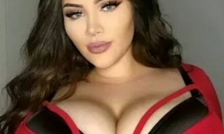 Rare condition causes woman’s boobs to grow six cup sizes in 14 months