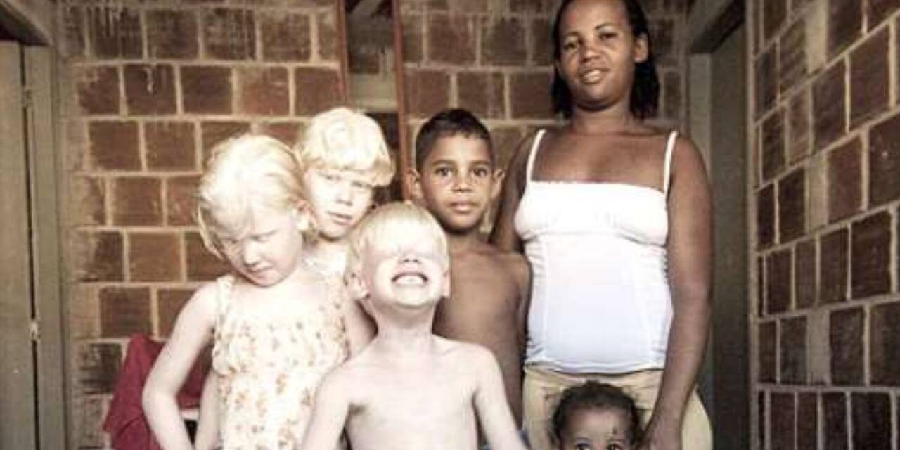 Black Parents with Three Albino Children