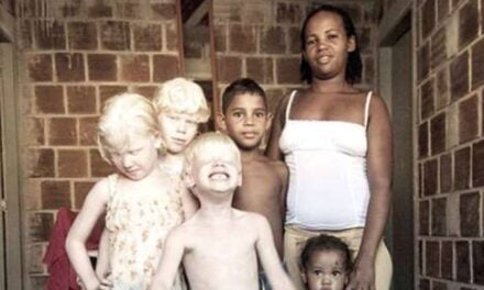 Black Parents with Three Albino Children