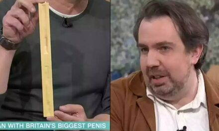 Man with ‘world’s biggest penis’ reveals thing he must do every time he wears shorts