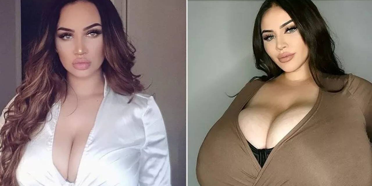 ‘My P-cup boobs won’t stop growing due to ultra rare condition – one bra costs me £140’