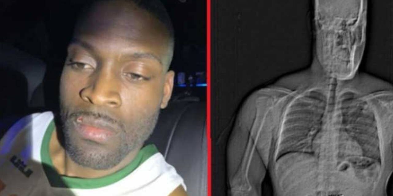 US man swallows over $700K worth of jewelry