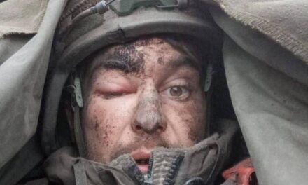 Russian Soldier Allegedly Fights for a Week with Bullet Stuck in His Brain