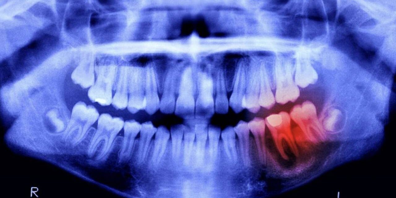 Humans May Be Able to Grow New Teeth Within Just 6 Years