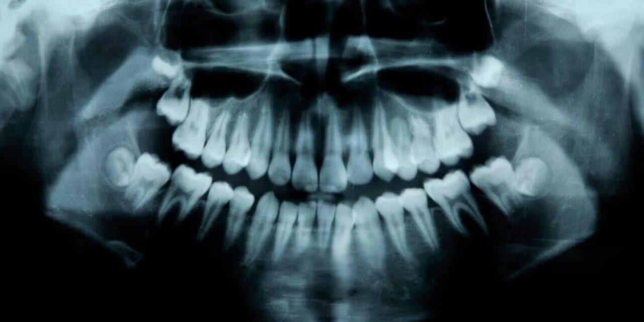 Humans Have a Third Set of Teeth. New Medicine May Help Them Grow.