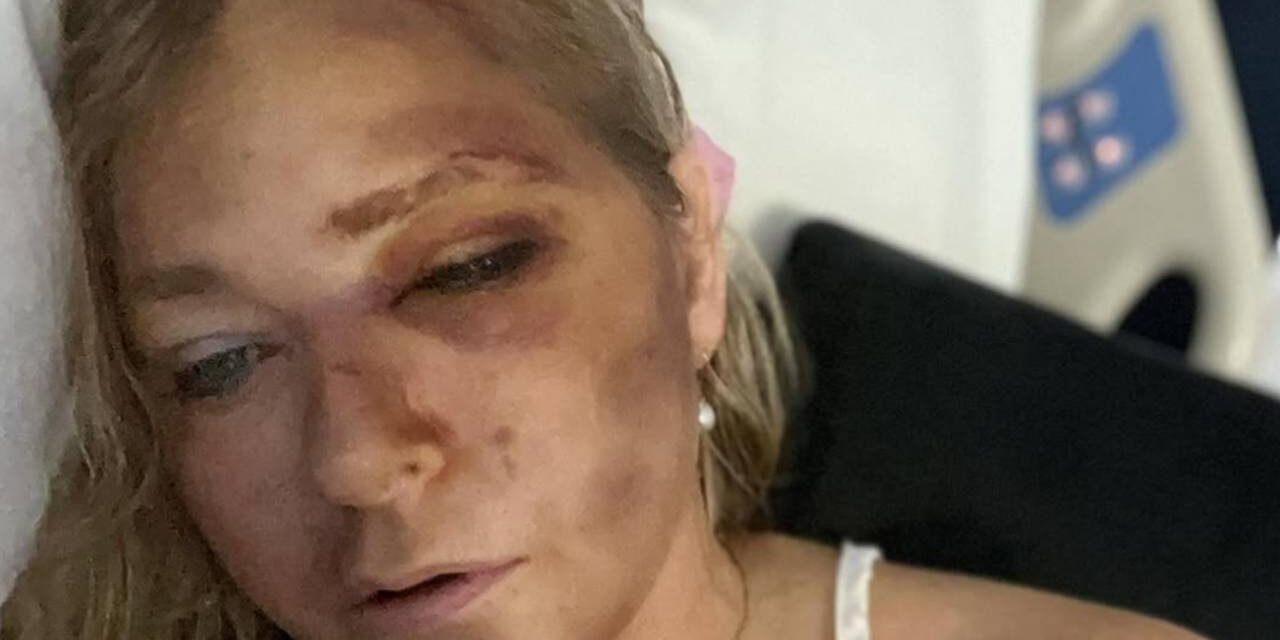 Epstein victim Virginia Giuffre flooded with well-wishes after revealing she has ‘days to live’