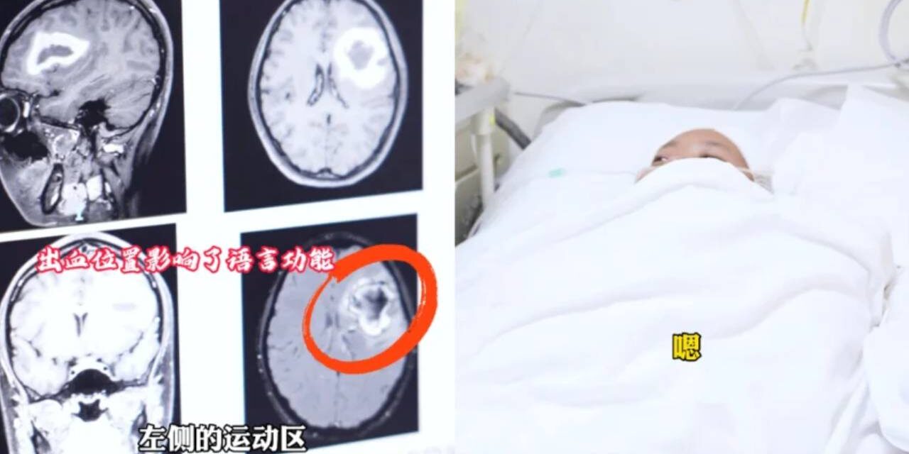 24-Year-Old Woman Mysteriously Stops Speaking Language She Was Fluent In