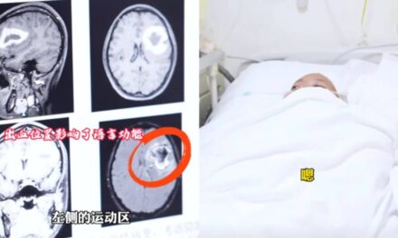 24-Year-Old Woman Mysteriously Stops Speaking Language She Was Fluent In