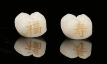 Bored with Skin Tattoos, Chinese Youths Are Increasingly Turning to Tooth Tattoos Instead