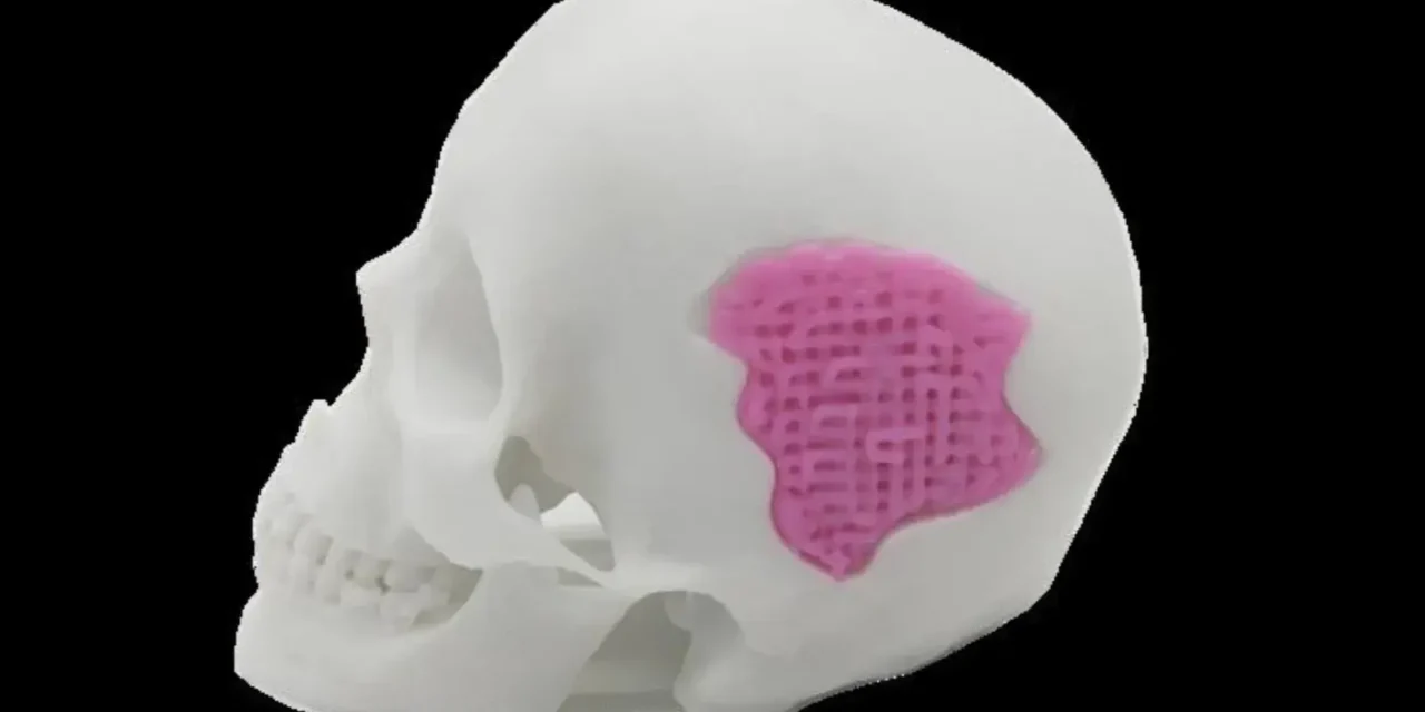 Scientists Can Now 3D Print Glass To Help Bones Grow Back