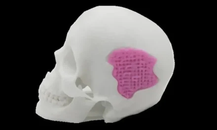Scientists Can Now 3D Print Glass To Help Bones Grow Back