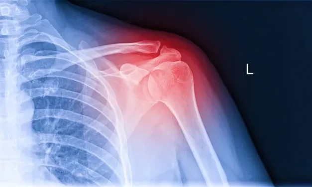 Scientists Can Now Use Glue Gun To Repair Broken Bones