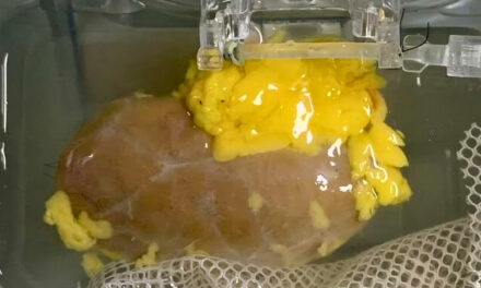 Breakthrough: Scientists Create ‘Universal’ Kidney To Match Any Blood Type