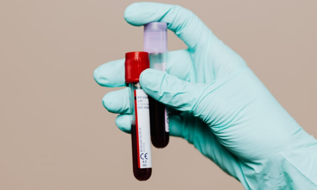 New Chronic Fatigue Syndrome ‘Blood Test’ Raises Hope And Skepticism