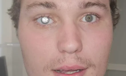 Man explains why he got $2million diamond embedded into his eye as shocked people say he looks like ‘Bond villain’