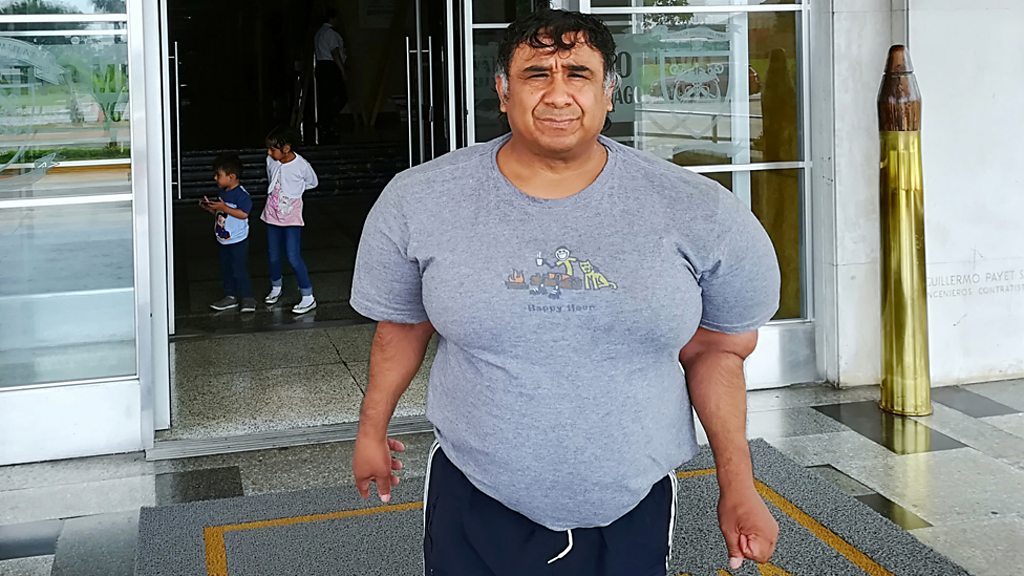 Freak Diving Accident Causes Man’s Body to Swell Up And Doctors Have No Idea How to Fix It