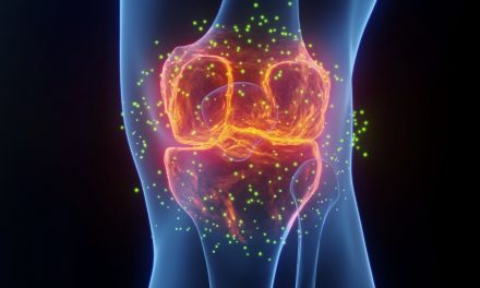 The Best Medicine For Joint Pain Isn’t What You Think, Says Expert