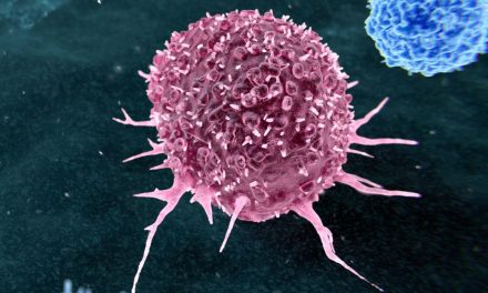 Most Preventable Cancers Are Linked to Just Two Lifestyle Habits