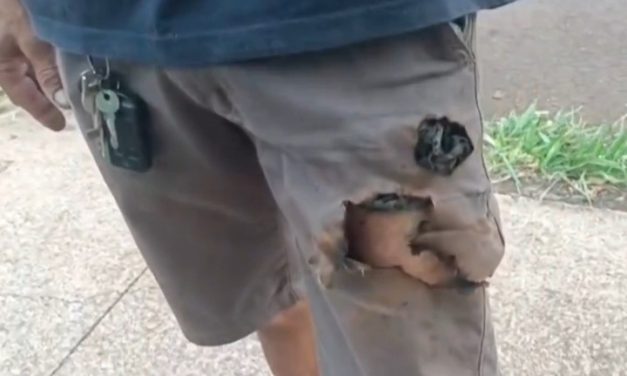 Man Attacked by Dogs Unexpectedly Saved by Exploding Phone in His Pocket