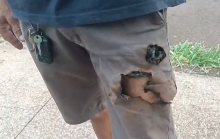 Man Attacked by Dogs Unexpectedly Saved by Exploding Phone in His Pocket