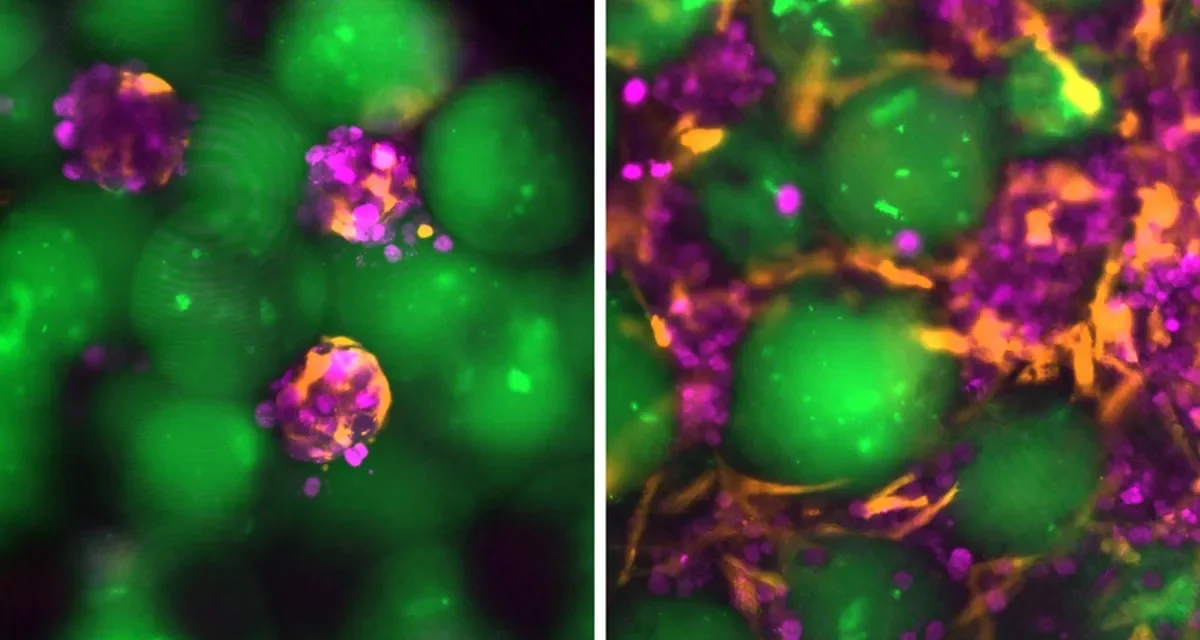 MIT Engineers Develop ‘Mini Livers’ That Can Be Injected Into the Body