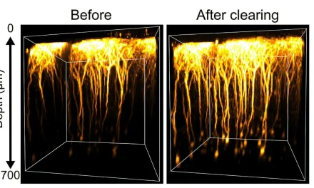 Scientists Make Live Brain Transparent